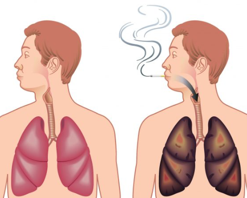 Samen sterk in rookstop en inhalatie