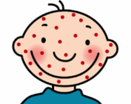 Kijk een vlekje! Kinderziektes onder de loep