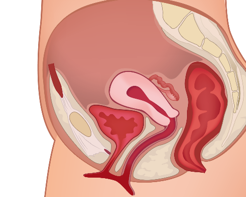 Gynaecologie in de spreekkamer: wat doet u?